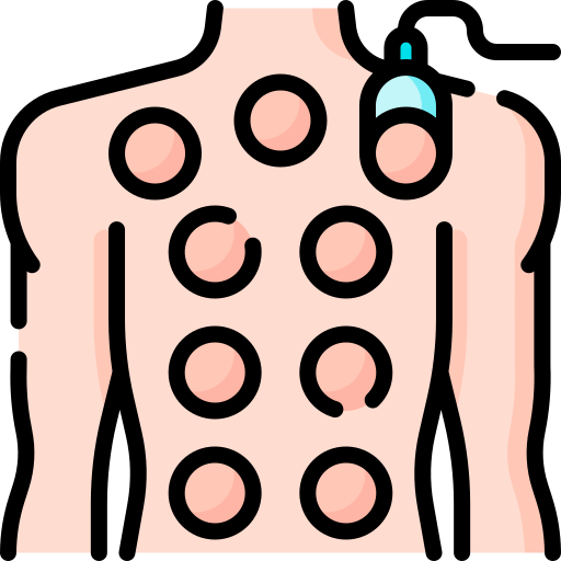 Cupping Therapy in Najafgarh